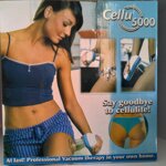 cellu-5000-apparecchio-coppettazione