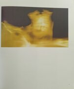 renato-meneghetti-radiografie