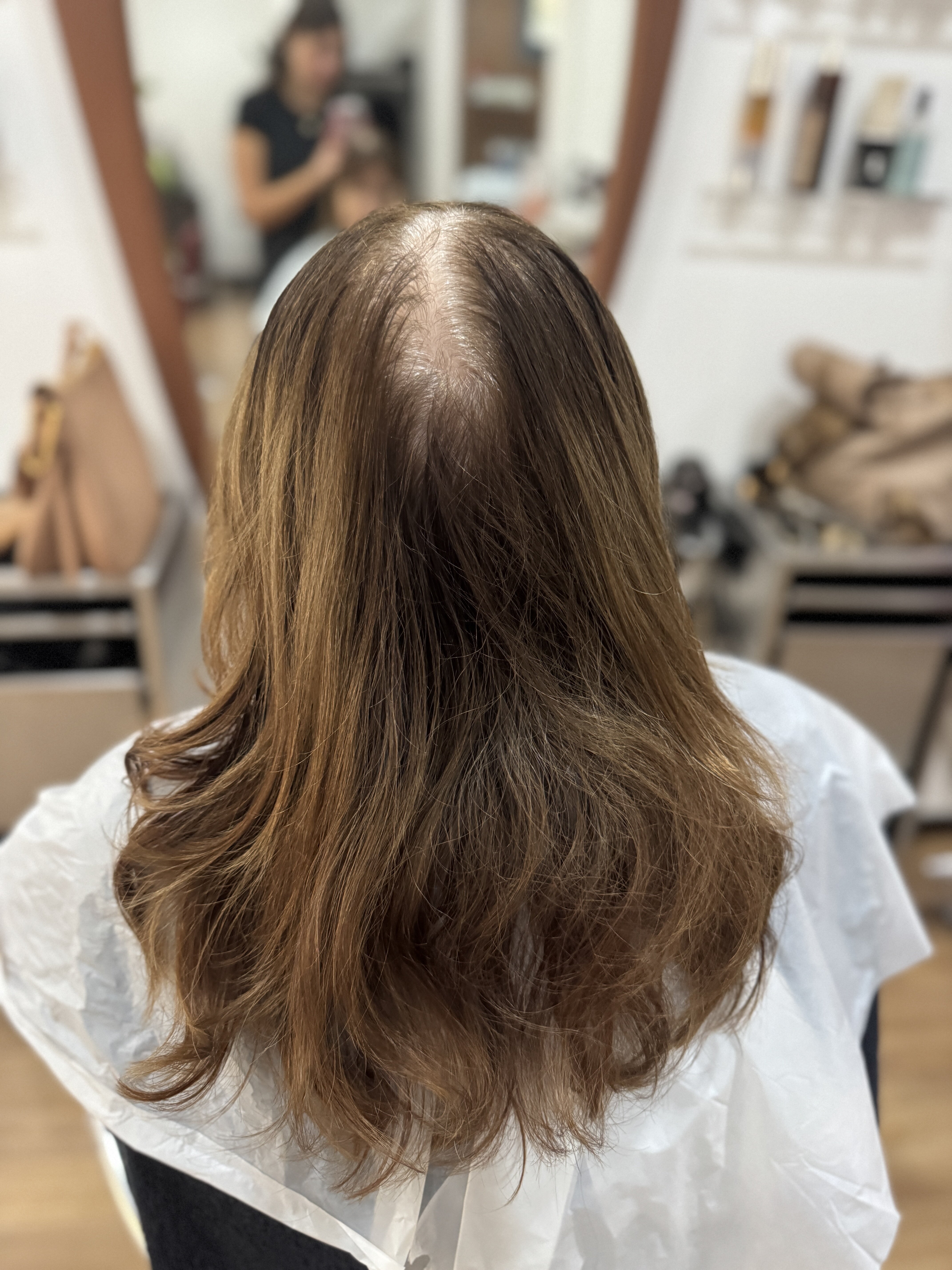 Caduta dei capelli in autunno: come affrontarla con i giusti trattamenti