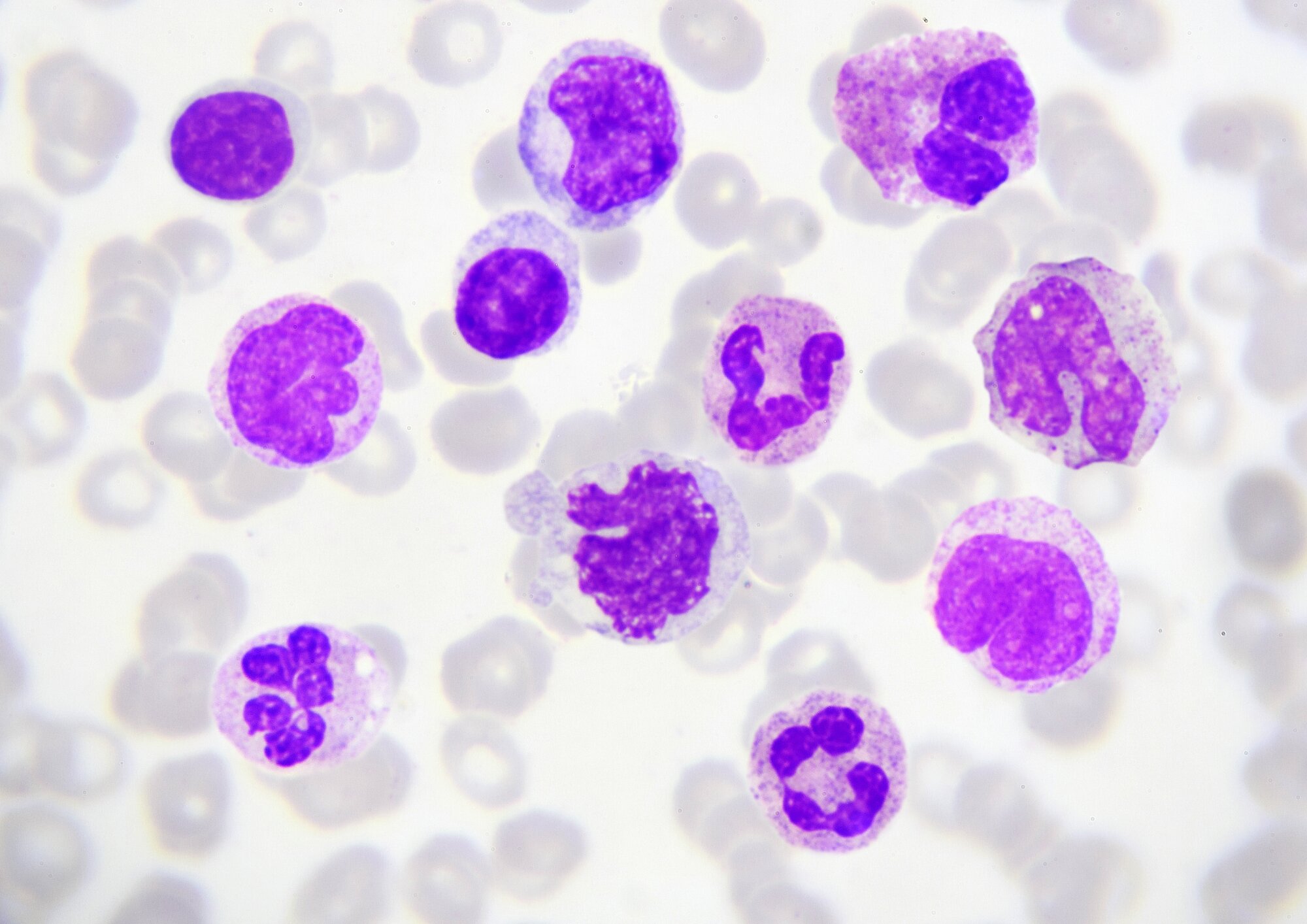 Allergologia e Immunologia Pediatrica