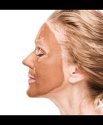 maschera-viso-algacollagen-lifting-antirughe