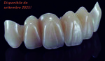 brecamhipc-tn-984x16