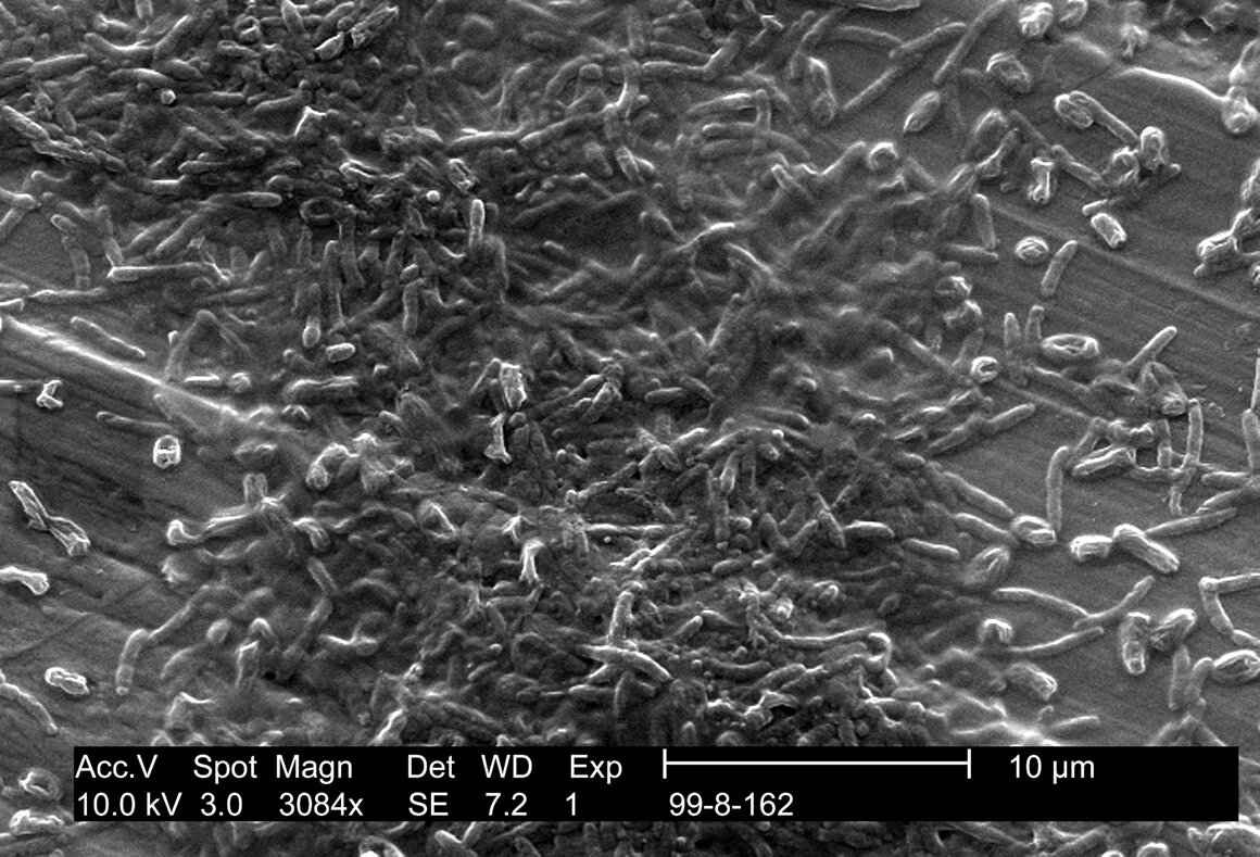 legionella-pneumophila-research.jpeg