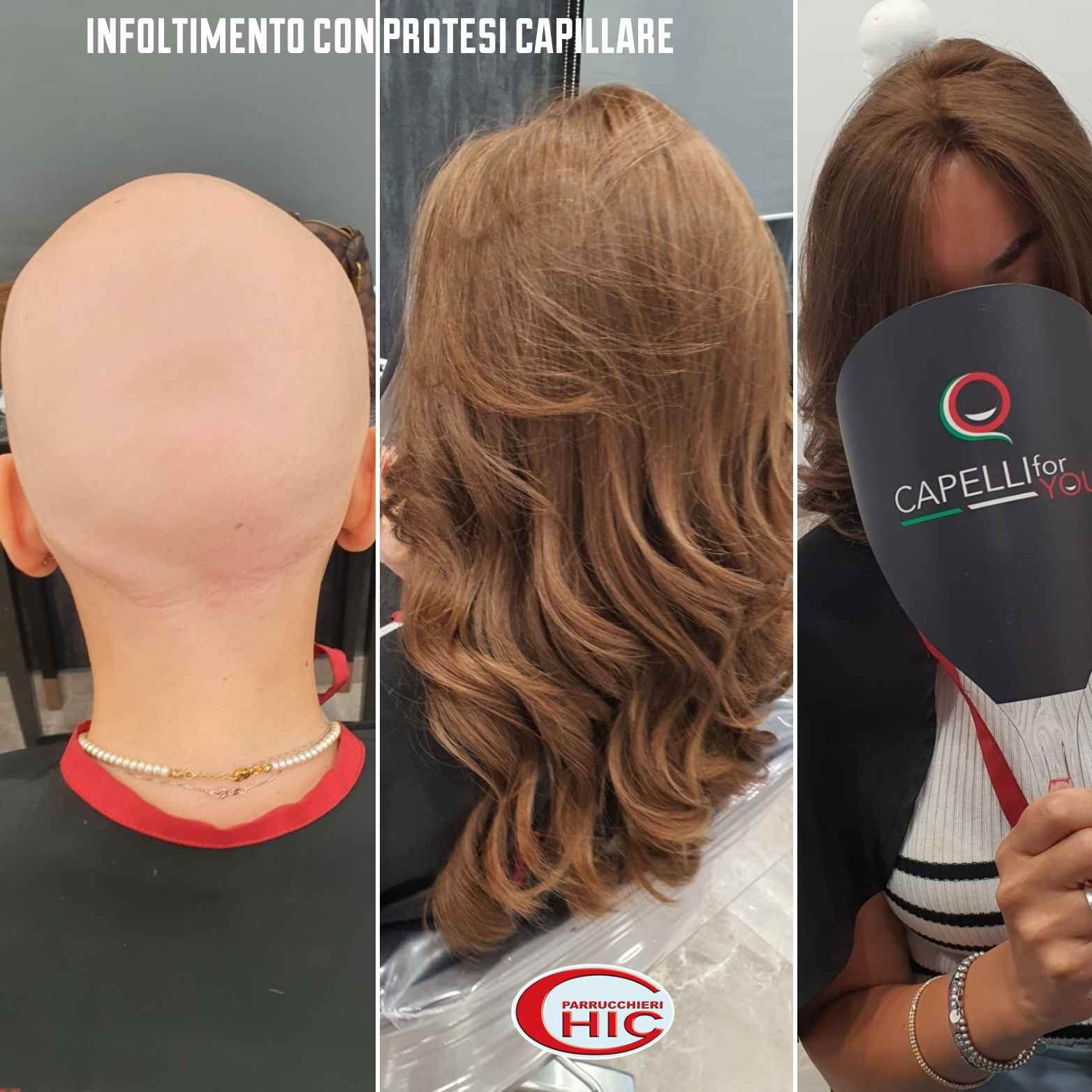 Miti da sfatare per le patch