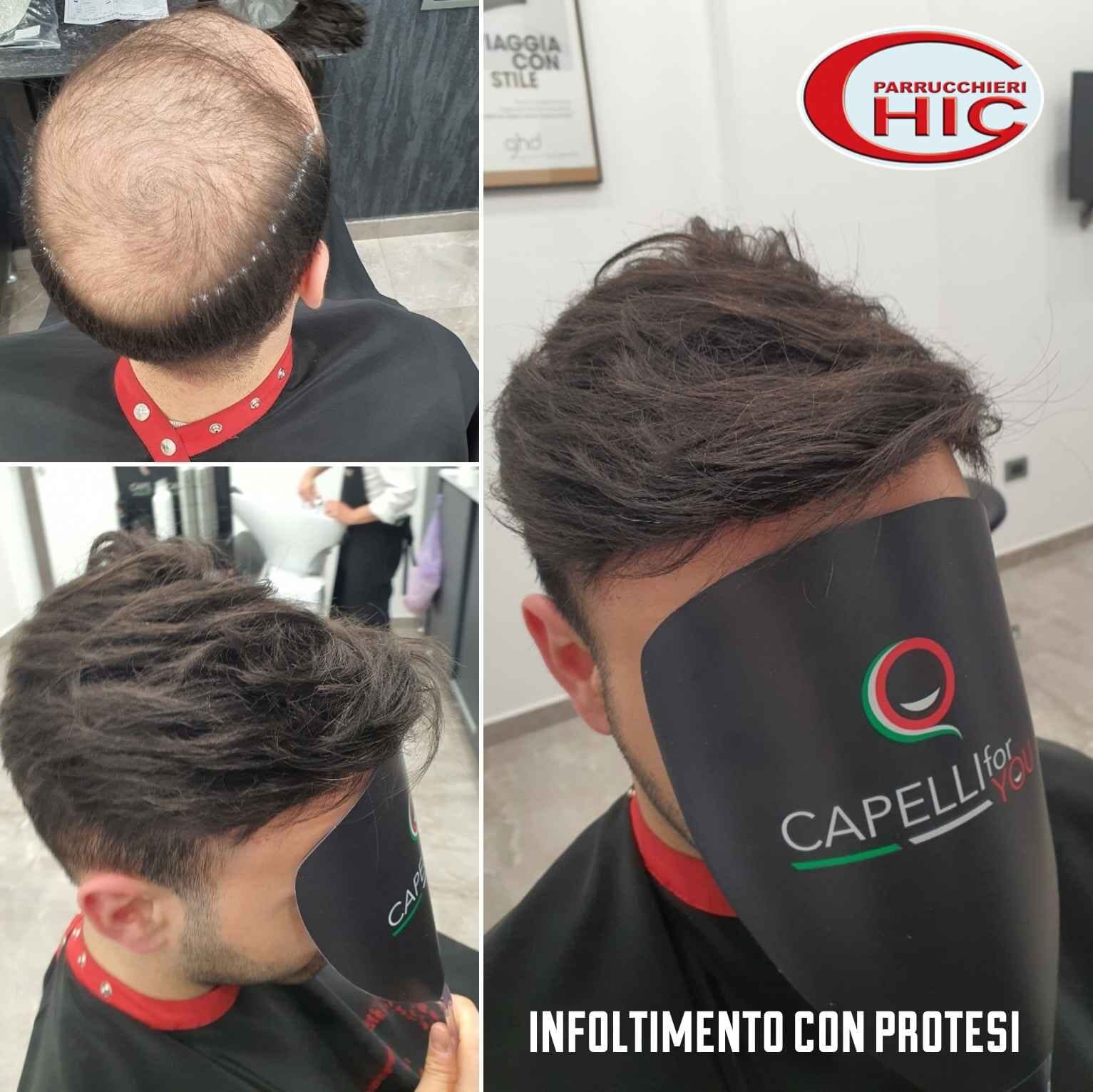 Ogni quanto va fatta la manutenzione della protesi capelli? Ogni quanto va fatta la manutenzione della protesi capelli?