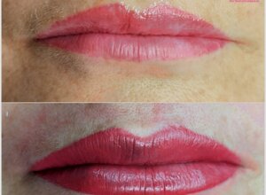 Dermopigmentazione labbra per cliente di Sassari prima e dopo risultato naturale