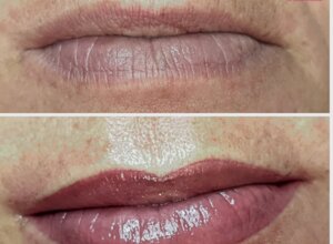 Contorno labbra semipermanente ad Alghero effetto naturale e definito