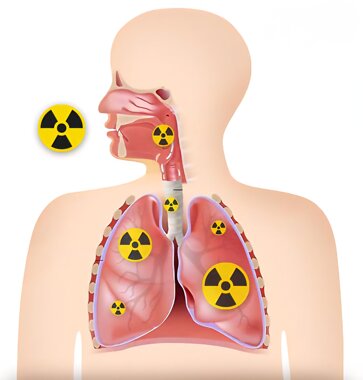 #radon #ambiente #Trieste #eliminare #esperto #gas #risanare #fvg #tumore #polmoni #respirazione