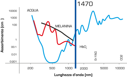 grafico 1470