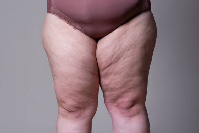 gambe_grosse.jpeg gambe_grosse.jpeg