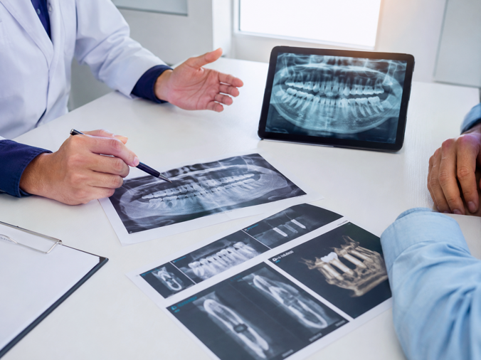 implantologia gallarate implantologia gallarate