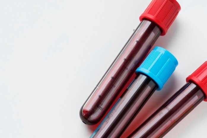 provette-sangue.jpeg