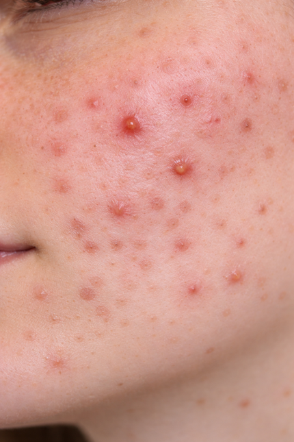 chatgpt image 26 mar 2026, 10_57_17