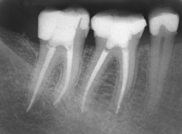 endodontie_gr.jpeg