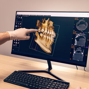 3d-cbct-img.jpeg