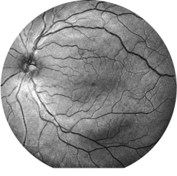 diabetic-retinopathy diabetic-retinopathy