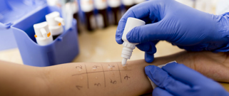 prick test
