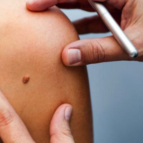 dermatologia
