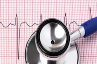 elettrocardiogramma2.jpeg