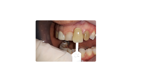 prima dello sbiancamento professionale prima dello sbiancamento professionale