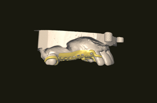 schel%20(1)