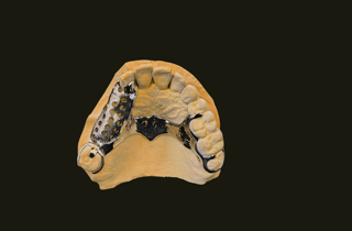 schel%20(2)