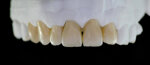 elemento-zirconia-ceramica