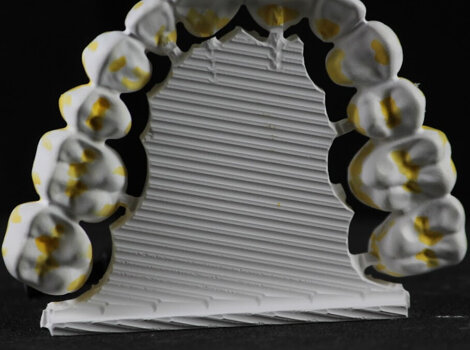 fresature full-arch di zirconia