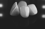 elemento-zirconia-34