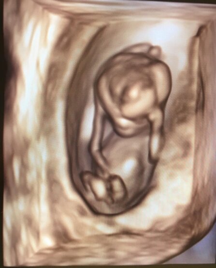 23499e995089b93e7fe04894b7b2a9ecb31d45f5 23499e995089b93e7fe04894b7b2a9ecb31d45f5