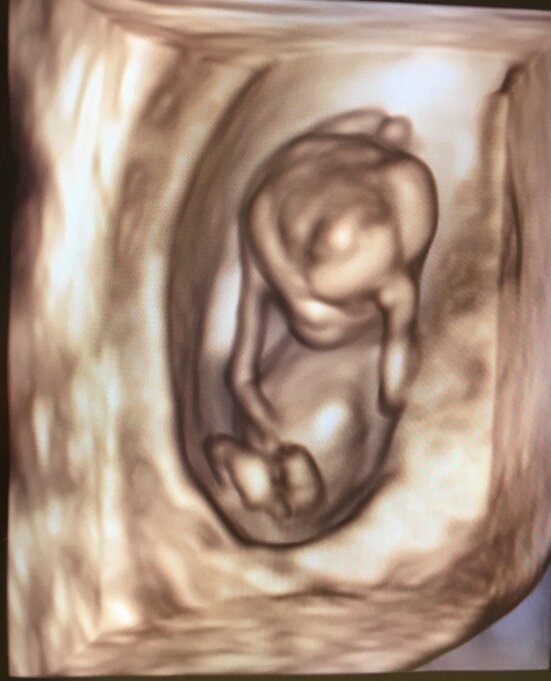 23499e995089b93e7fe04894b7b2a9ecb31d45f5