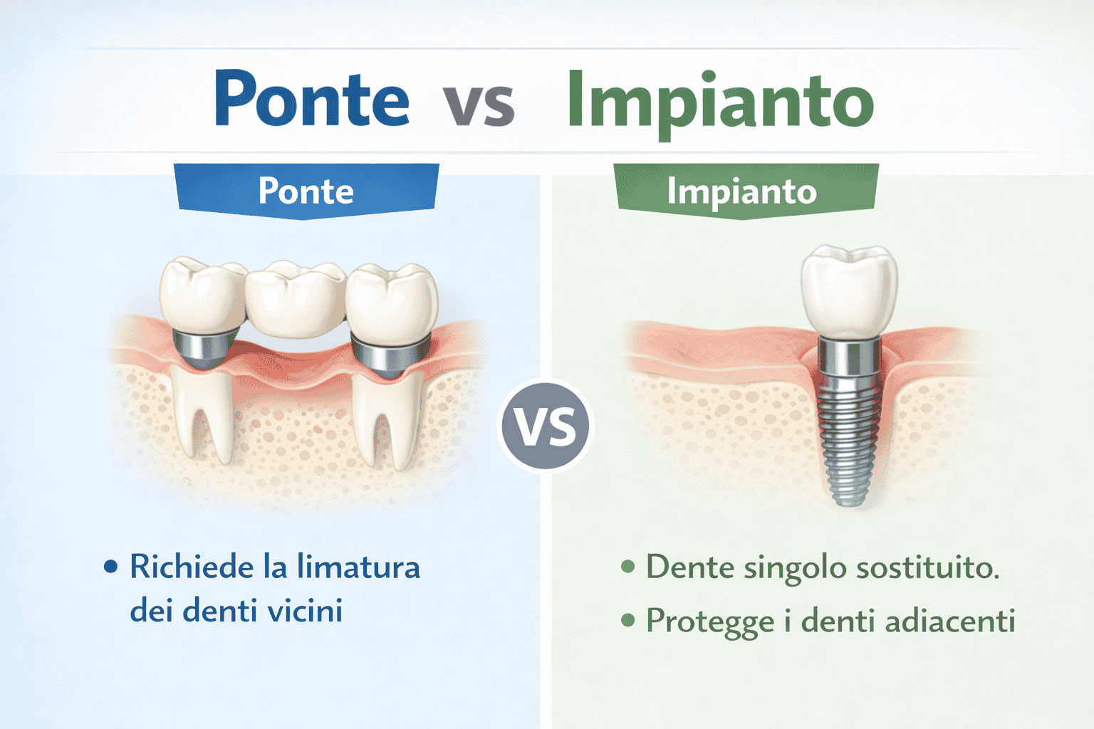 Impianto Singolo o Ponte Dentale? Guida alla Scelta Ottimale per il Tuo Sorriso