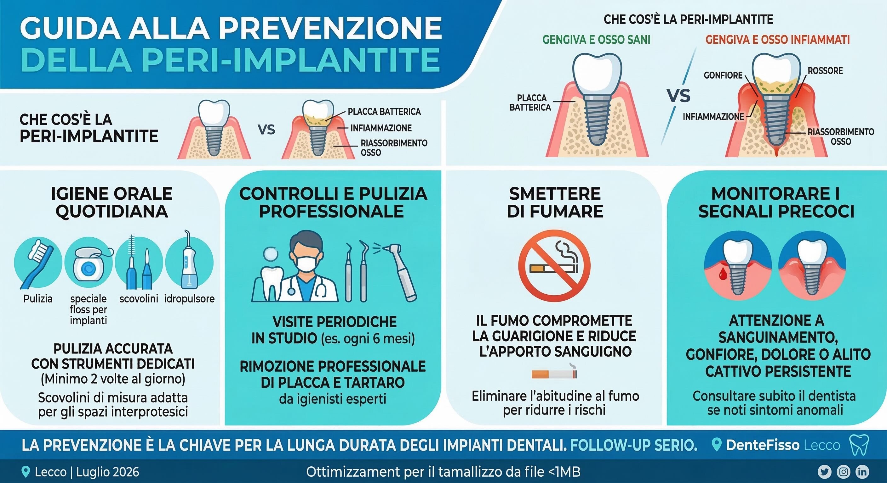 Peri-implantite: Come Proteggere i Tuoi Impianti Dentali nel Tempo