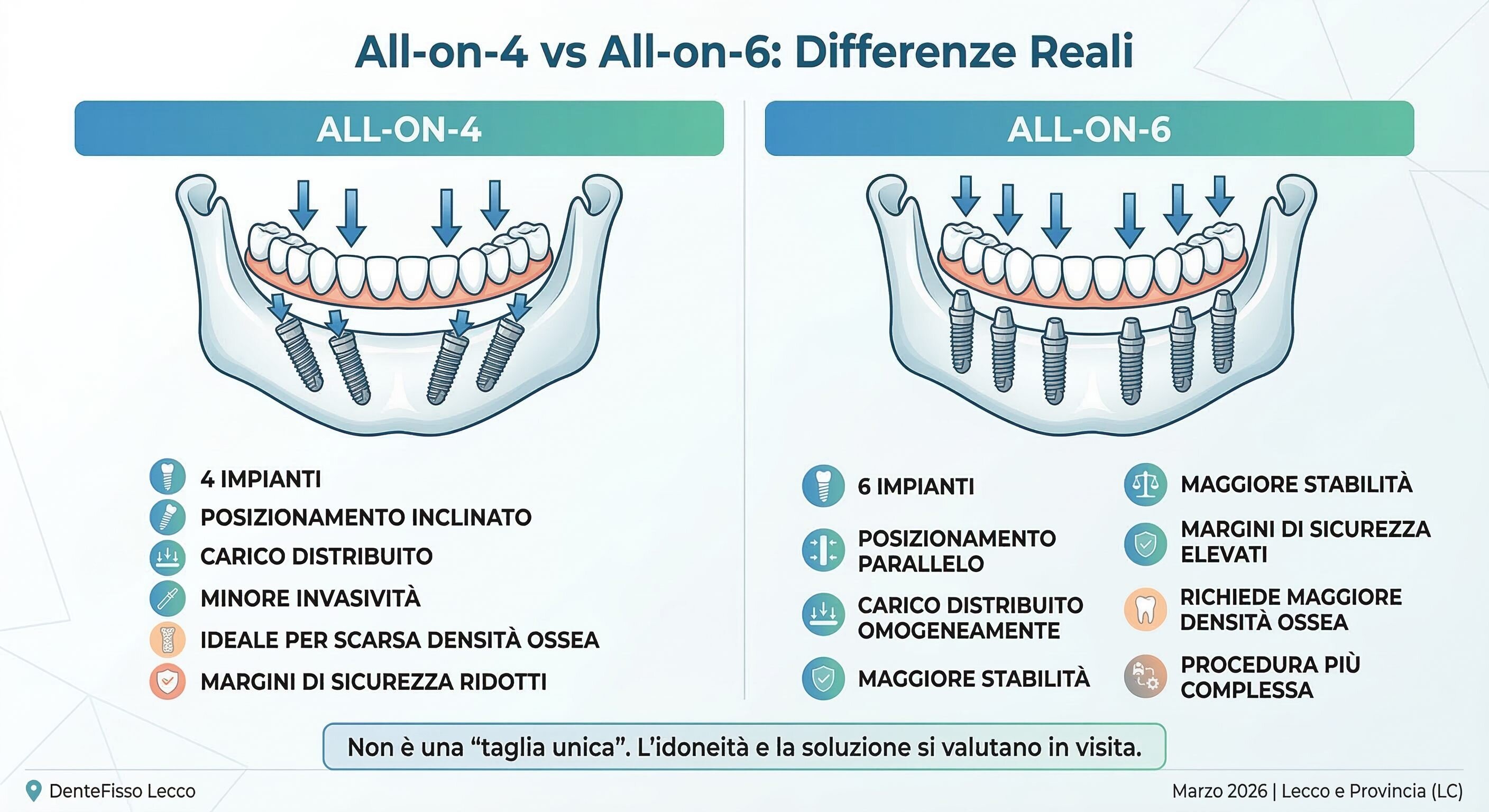 Scegliere tra All-on-4 e All-on-6: Guida pratica per i pazienti di Lecco e Provincia