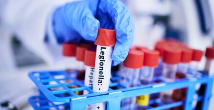 cesnir-qualita-aria-legionella.jpeg