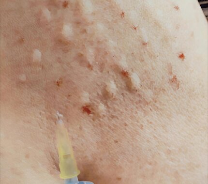 mezo-zhivot-q71mc3buh8bwqq9fe4om6cv6c23xfhplhnx7qy9fi0.webp mezo-zhivot-q71mc3buh8bwqq9fe4om6cv6c23xfhplhnx7qy9fi0.webp