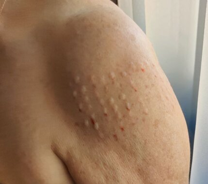 screenshot_2025-03-25-18-05-06-26_f9ee0578fe1cc94de7482bd41accb329.jpeg screenshot_2025-03-25-18-05-06-26_f9ee0578fe1cc94de7482bd41accb329.jpeg