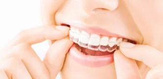 ortodonzia-invisibile_cover-scaled