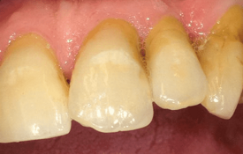 0d6ee066a485191ae1e7238df1d6ef5dab1e667f