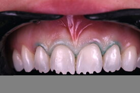 465ea3223163fefa7b19debcfbeadae3037b03ea