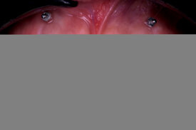 5270fcfa52c12f5758e005443a6e1fa7cad93da2