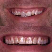 b5bbf9bafc2730153fae72428c904a1a4fcc7b83