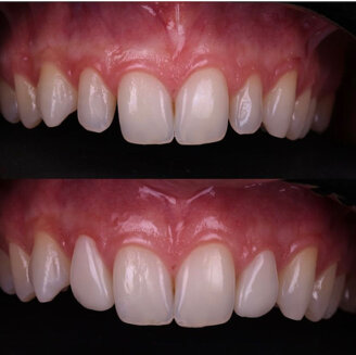 d910799c5336696f921de0759522b3095596a4fe