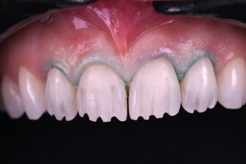 e0cee35715582a1fe708643f174ba06d8e3a6bad