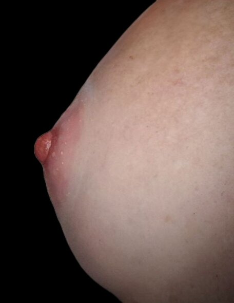 profilo mynipple.jpeg