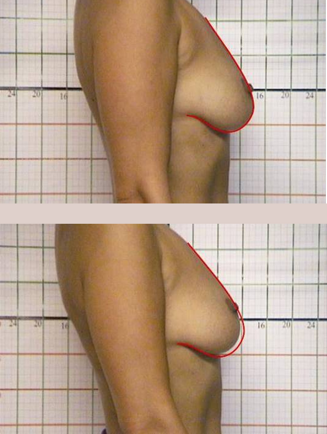 f3c7224a982df4c9187af9b6335ac3005d519869