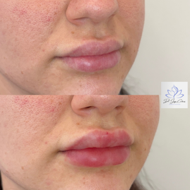 black white minimalist hair beauty before after instagram post