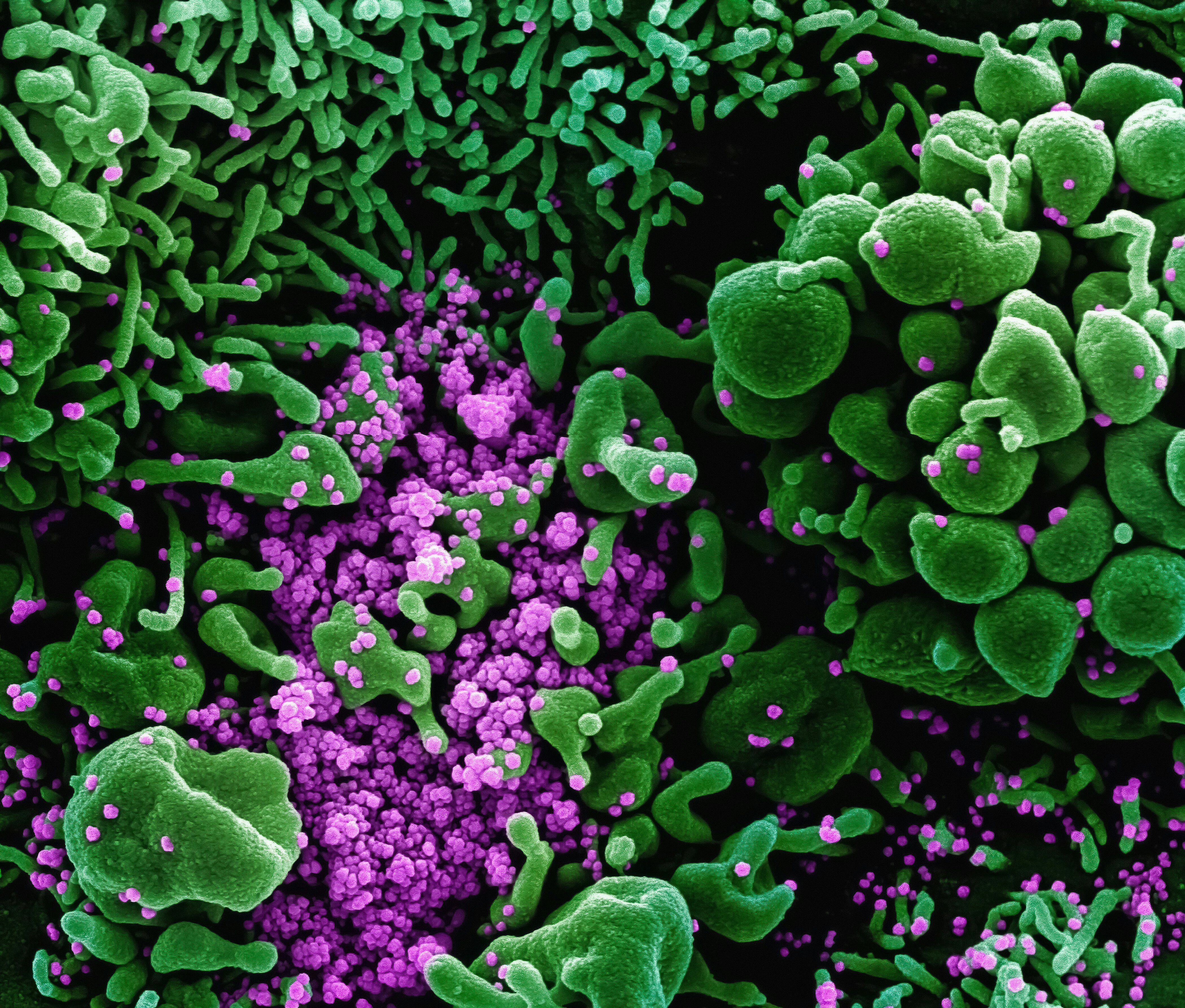 microbioma-menopausa-gonfiore.jpeg
